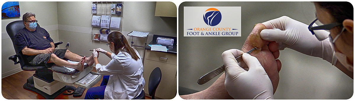 OCfeet.com - diabetic Foot and wound care - OCFA - Surgery - Podiatry - Diabetes Foot care