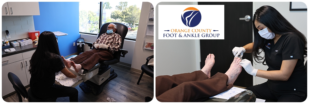 Diabetic Foot Care - OCfeet.com - Orange County