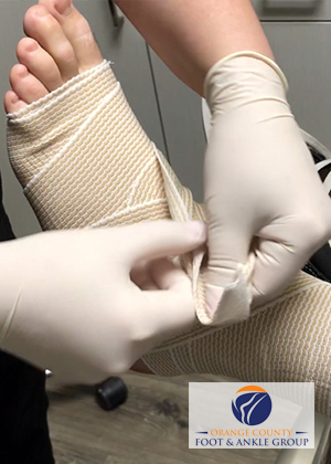 Basketball injury wrap with Ace Bandage - Sports Injuries - OCfeet.com - Orange County Podiatrist
