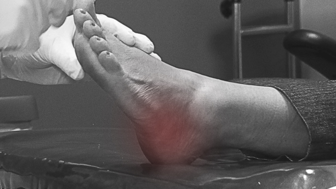 Heel Pain OCfeet.com