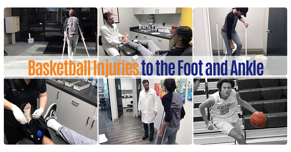 Basketball Injuries Featured Image 1200×628 Basketball injuries to the foot and ankle