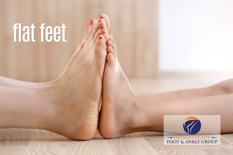 Flat feet - Featured Image - OCfeet.com