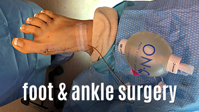 Foot & Ankle Surgery