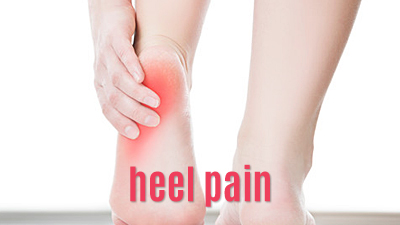 Heel Pain (Plantar Fasciitis)