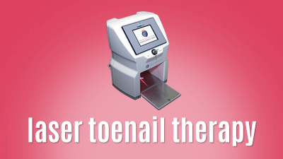 Laser Toenail Fungus Therapy