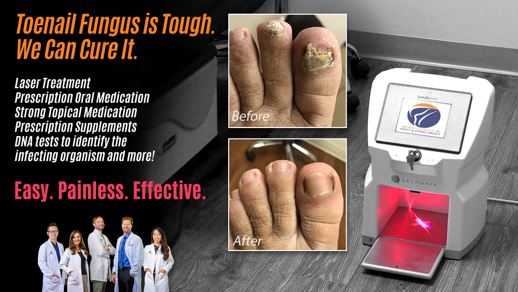 Nail Fungus Treatment Device, Portable Cold Laser Therapy, Nail Cleaning  and Care Device, Rechargeable Finger Toe Care Accessories, Home Use,  Painless, Healing of Fungal Onychomycosis : Amazon.com.au: Health,  Household & Personal Care